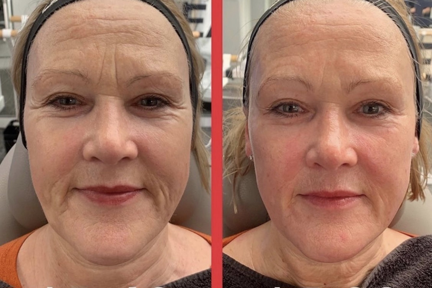 Maria Garcia - antes y después